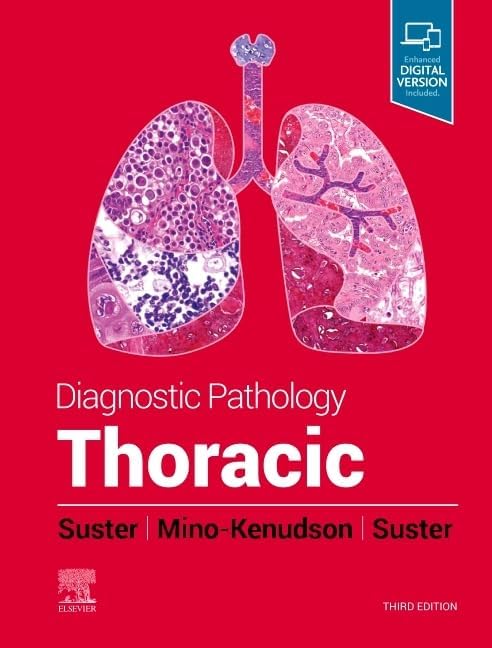 Diagnostic Pathology: Genitourinary: 9780323763325: Medicine